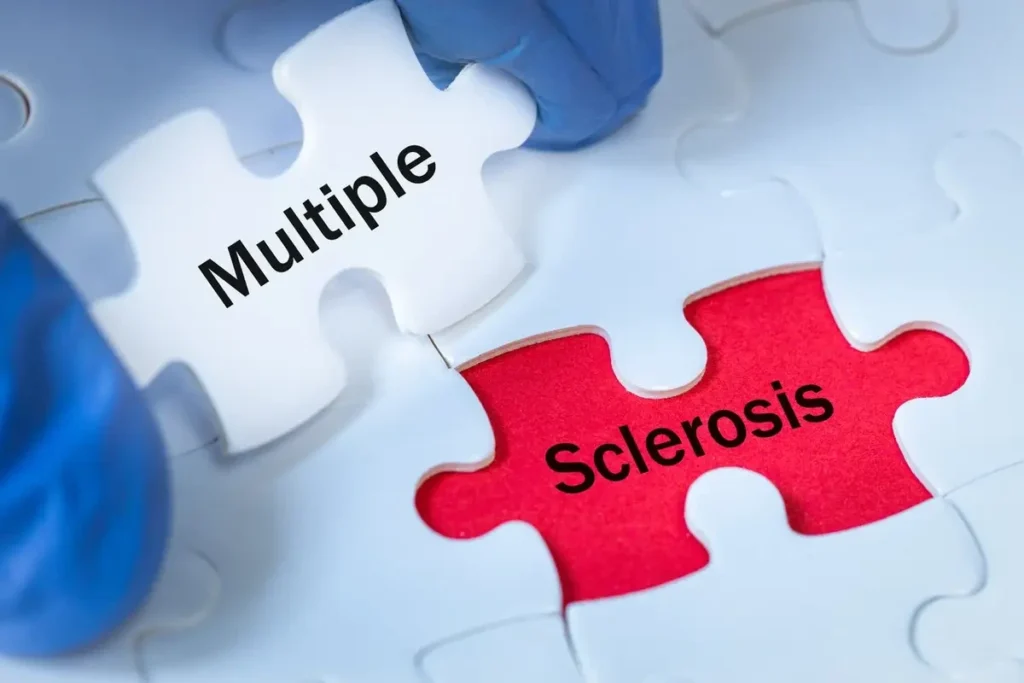 Image showing multiple sclerosis written