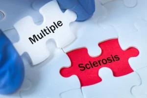 Image showing multiple sclerosis written