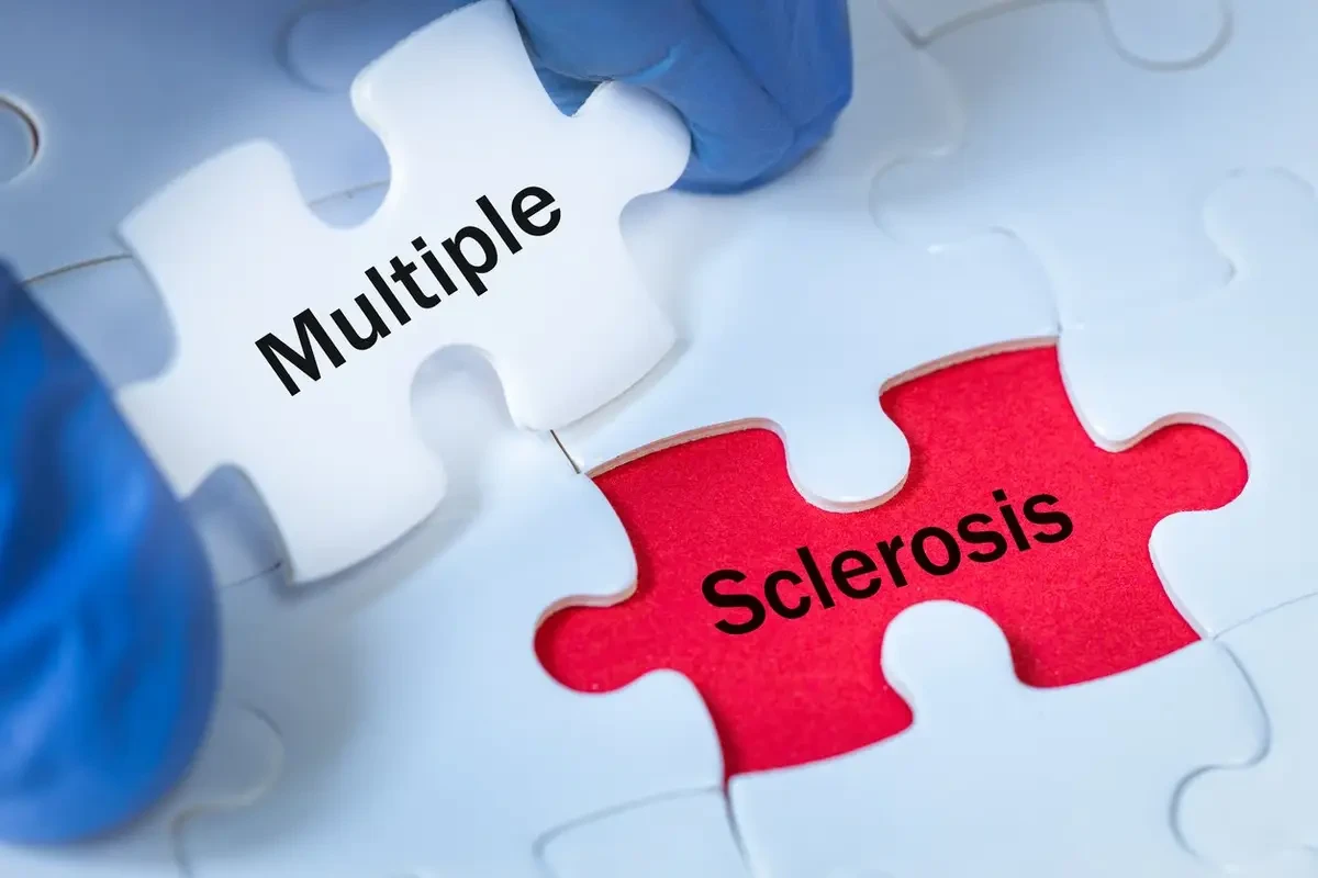 Image showing multiple sclerosis written