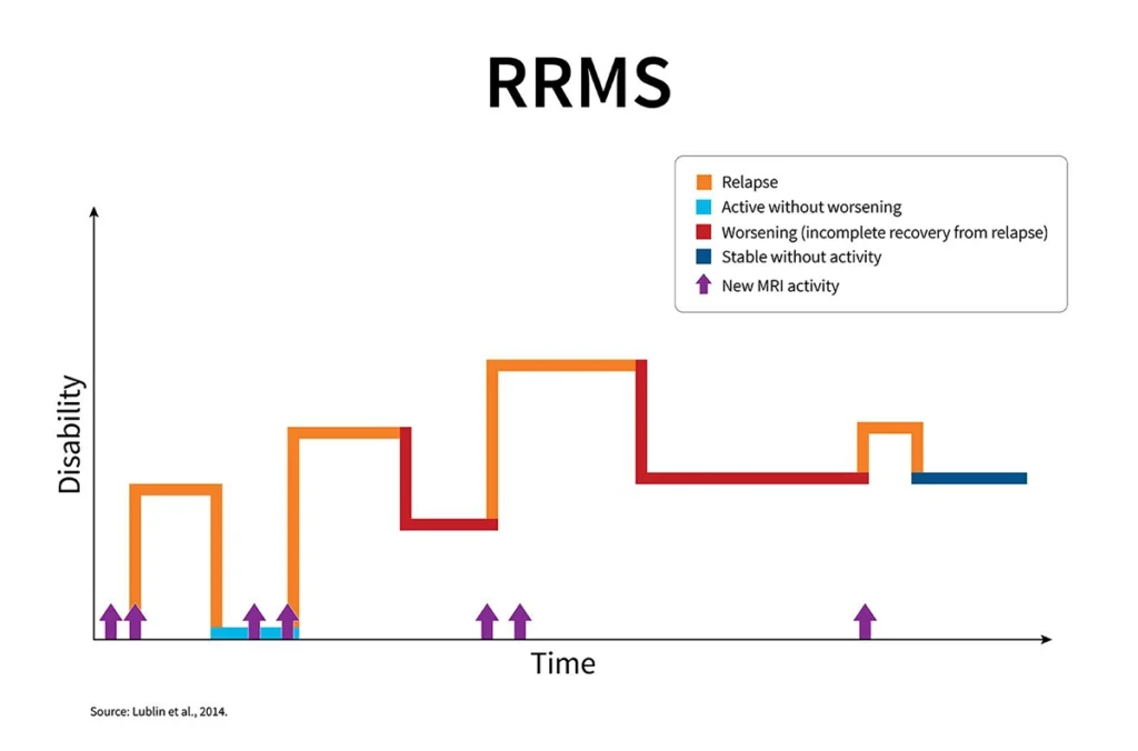 relapsing remitting multiple sclerosis symptoms
