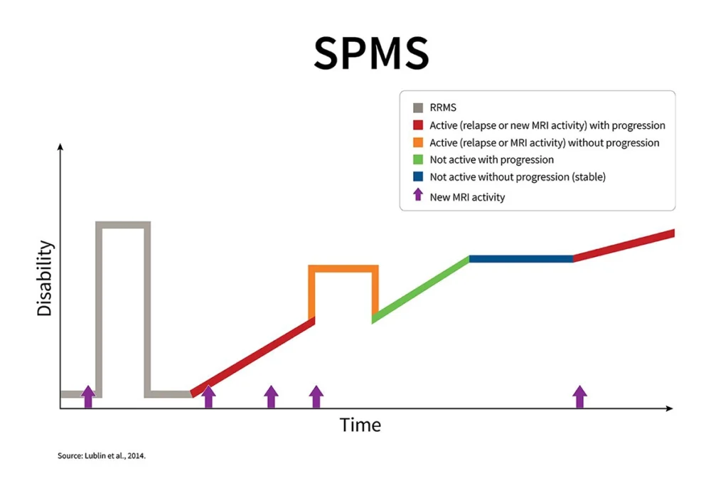 secondary progressive multiple sclerosis